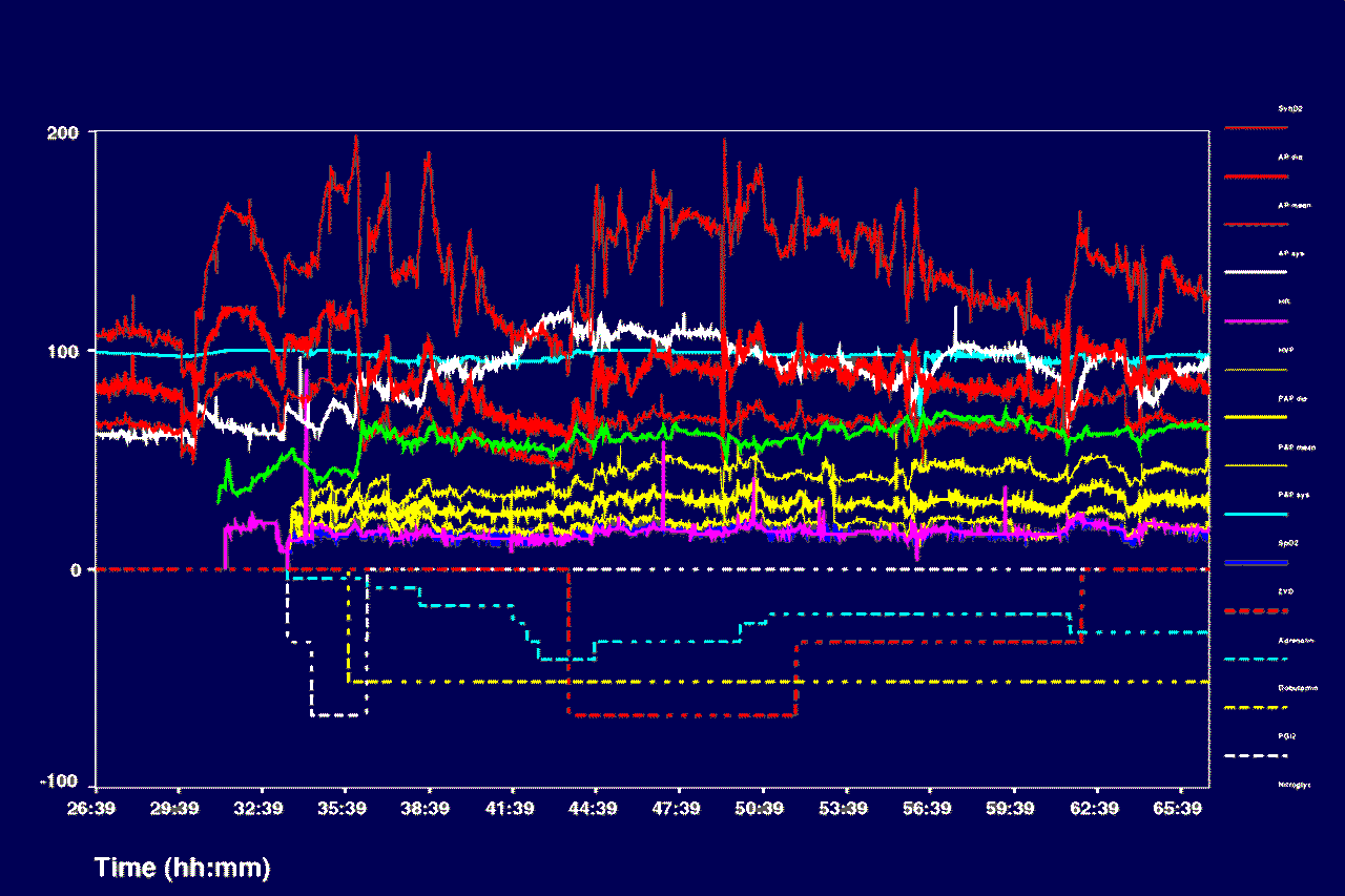 Mewertkurven verschiedener intensivmedizinischer     Mewerte im Zeitablauf